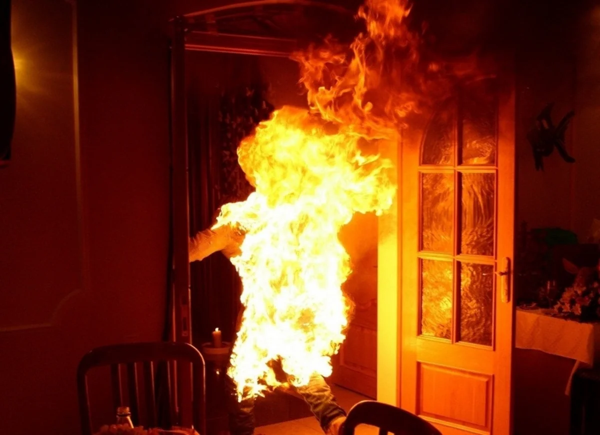 Gəncədə özünü yandıran 18 yaşlı oğlan xəstəxanada ölüb