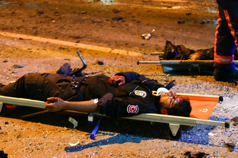 Al Jazeera Turk: İstanbuldakı partlayışda ölənlər var - FOTO - VİDEO