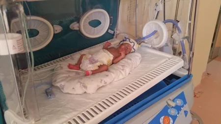 Bakıda həkimlər 650 qram çəki ilə dünyaya gələn körpənin yaşamasına nail olub - FOTO