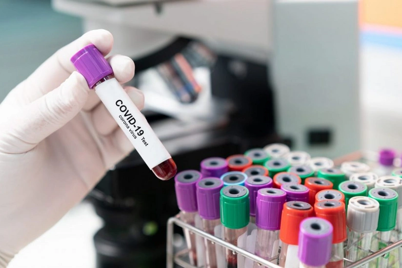 New COVID deaths exceed 40 in Azerbaijan 