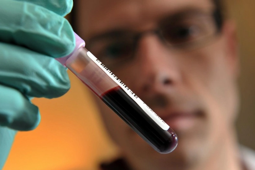 Tokio-2020: Keniyalı atletdə dopinq aşkarlanıb