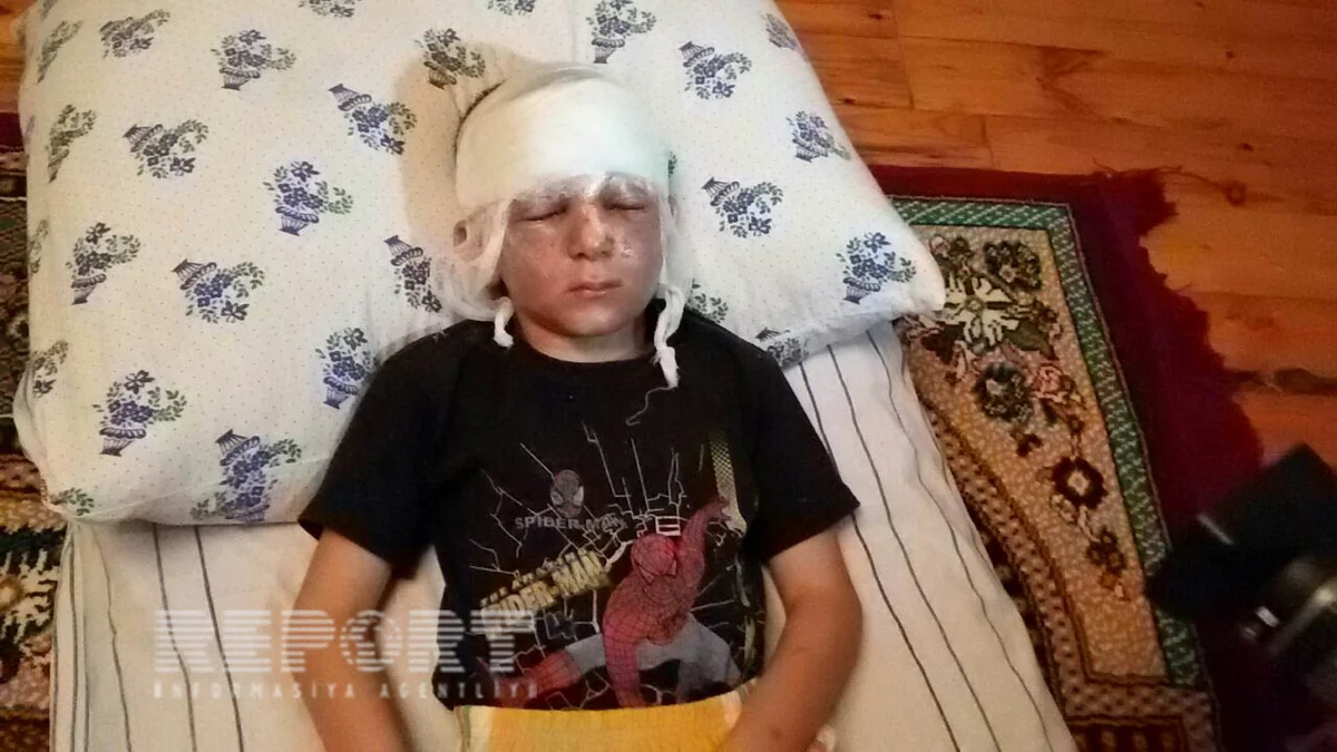 ​Tərtərdə hərbi sursatın partlaması nəticəsində azyaşlı xəsarət alıb