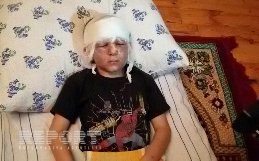​Tərtərdə hərbi sursatın partlaması nəticəsində azyaşlı xəsarət alıb