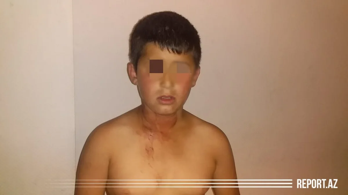 Polis uşağın atası tərəfindən bıçaqlanması ilə bağlı açıqlama verib