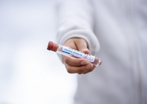 Azerbaijan confirms 840 new coronavirus cases, nine deaths