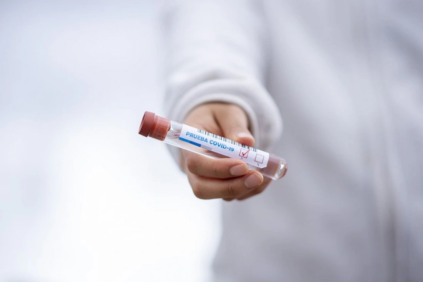 Azerbaijan confirms 840 new coronavirus cases, nine deaths