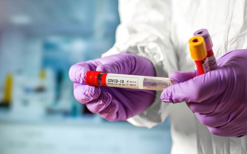 Deputat: Koronavirus testlərinin qiyməti aşağı salınmalıdır