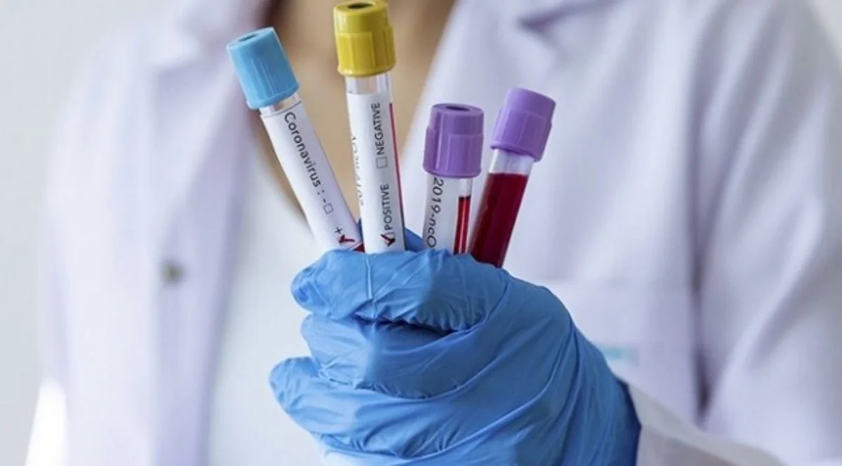 İranda koronavirusdan ölənlərin sayı artır - YENİLƏNİB