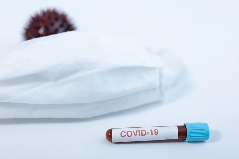 Azerbaijan confirms 22 new COVID-19 cases, 5 deaths