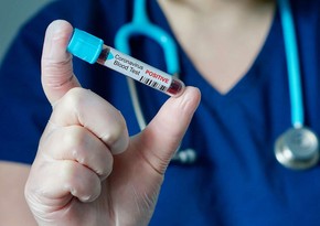 В Азербайджане более 300 журналистов заразились COVID-19, 14 человек скончались