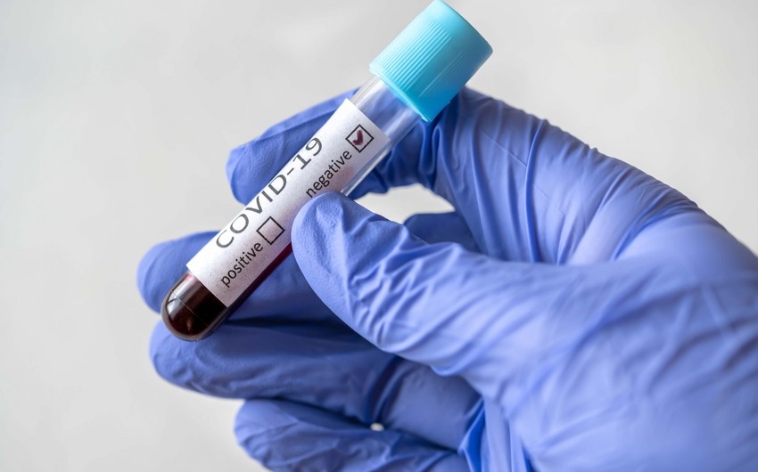 Səhiyyə Nazirliyi koronavirus testləri ilə bağlı narazılıqlara münasibət bildirib