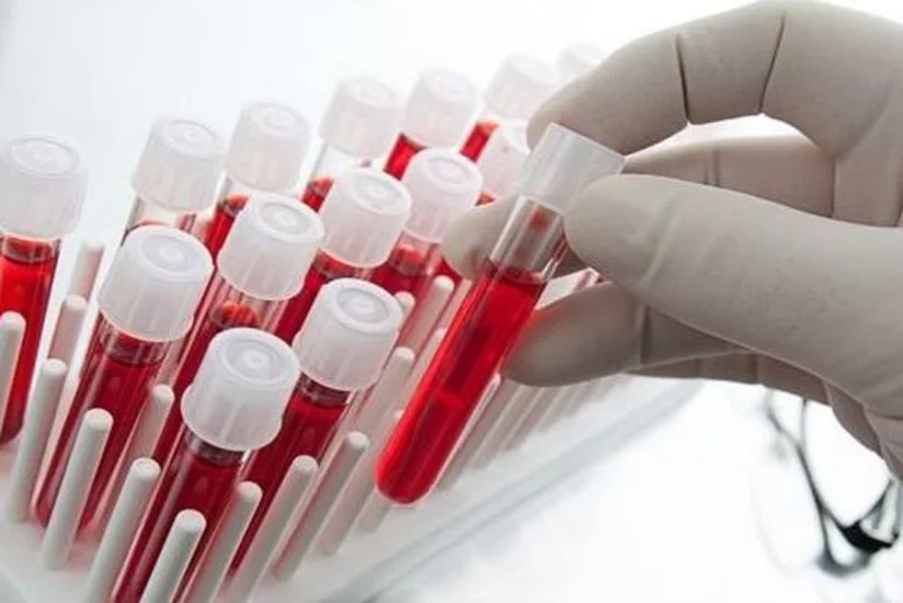Baş hematoloq: Azərbaycanda qan tədarükü ilə məşğul olan müəssisələrin əksəriyyəti qeyri-effektiv işləyir
