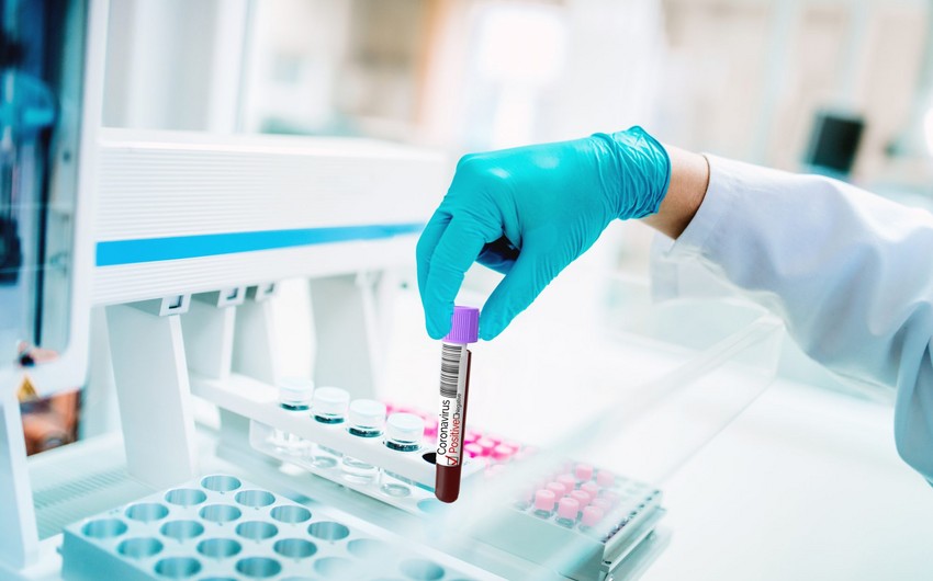 Azerbaijan confirms 2,206 new COVID-19 cases, 35 died