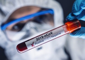 Deputat: “Koronavirus pandemiyası davam edir, arxayınlaşmaq olmaz”