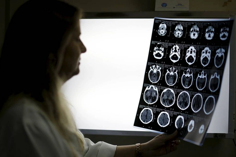 Schizophrenia increases risk of dying from COVID-19