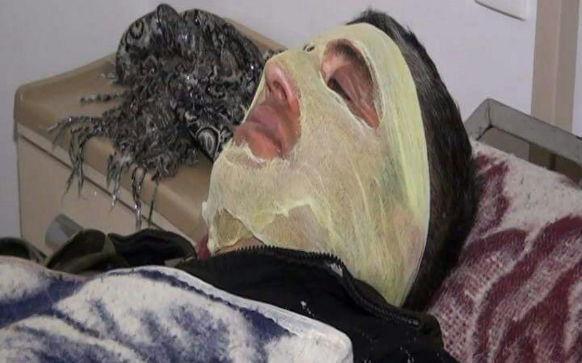 Tovuzda fərdi yaşayış evində qaz balonu partlayıb, xəsarət alan var - FOTO