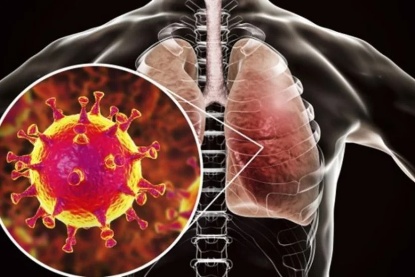 Almaniyada koronavirusa yoluxanların sayı artdı