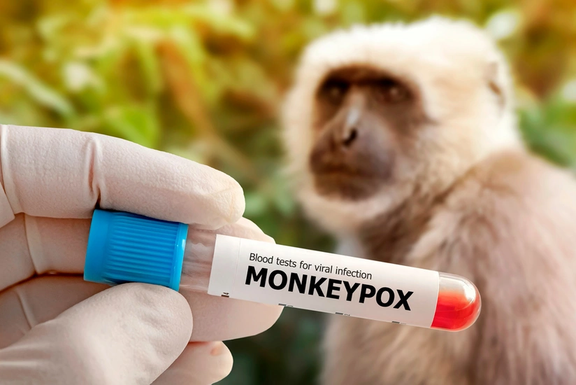 Afrikada meymunçiçəyi epidemiyası sürətlə yayılır