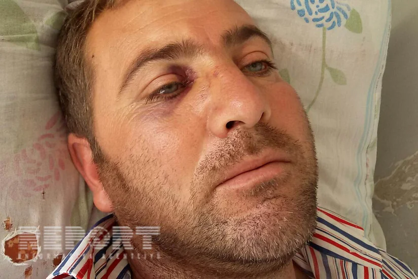 Tərtərdə bir necə nəfərin xəsarət alması ilə nəticələnən kütləvi dava baş verib - FOTO