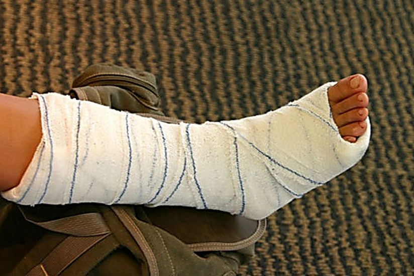 Qobustanda əyləncə mərkəzində yıxılan yeniyetmənin ayağı sınıb