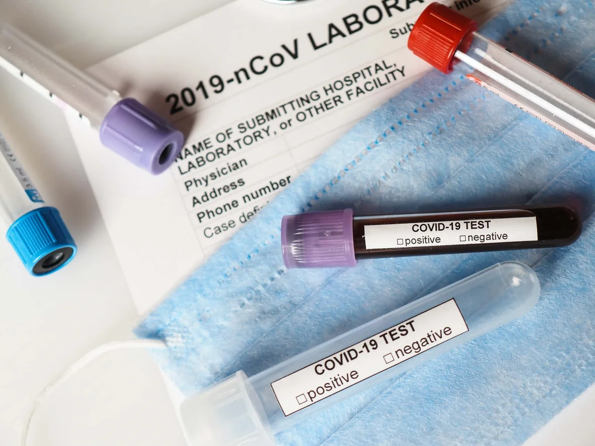 Health minister says situation with coronavirus stable in Azerbaijan