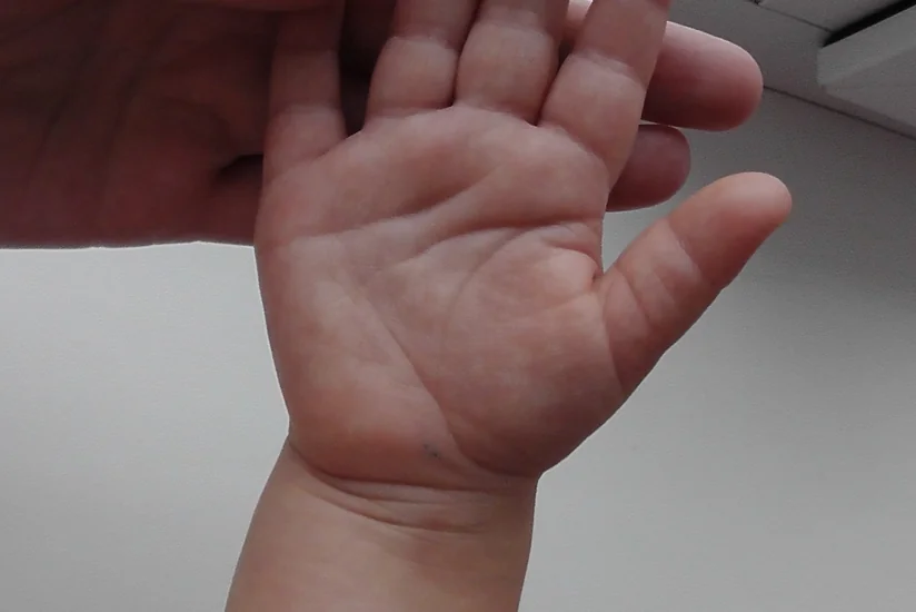 Bakıdakı klinikalardan birində 5 yaşlı uşaq ölüb