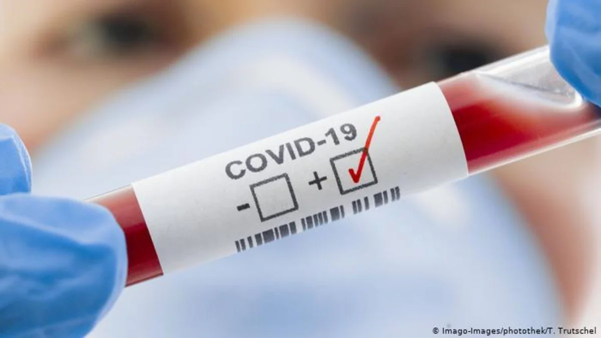 В Молдове число случаев COVID-19 выросло до 8 251