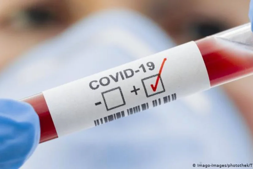 В Молдове число случаев COVID-19 выросло до 8 251