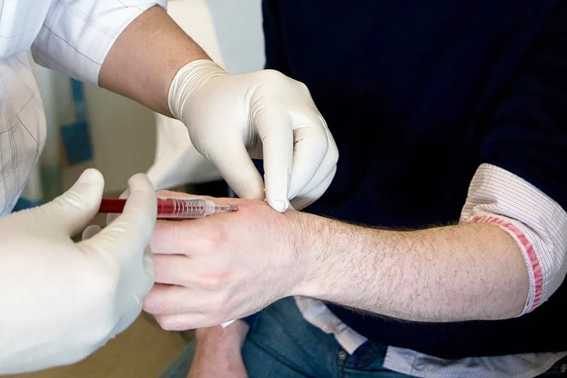 Avropada çipli insanlara münasibət öyrənilib - SORĞU