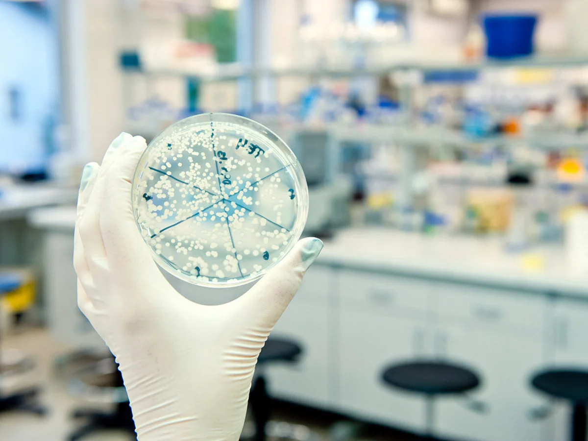 ÜST: Yeni koronavirus başqa ölkələrdə də yayıla bilər