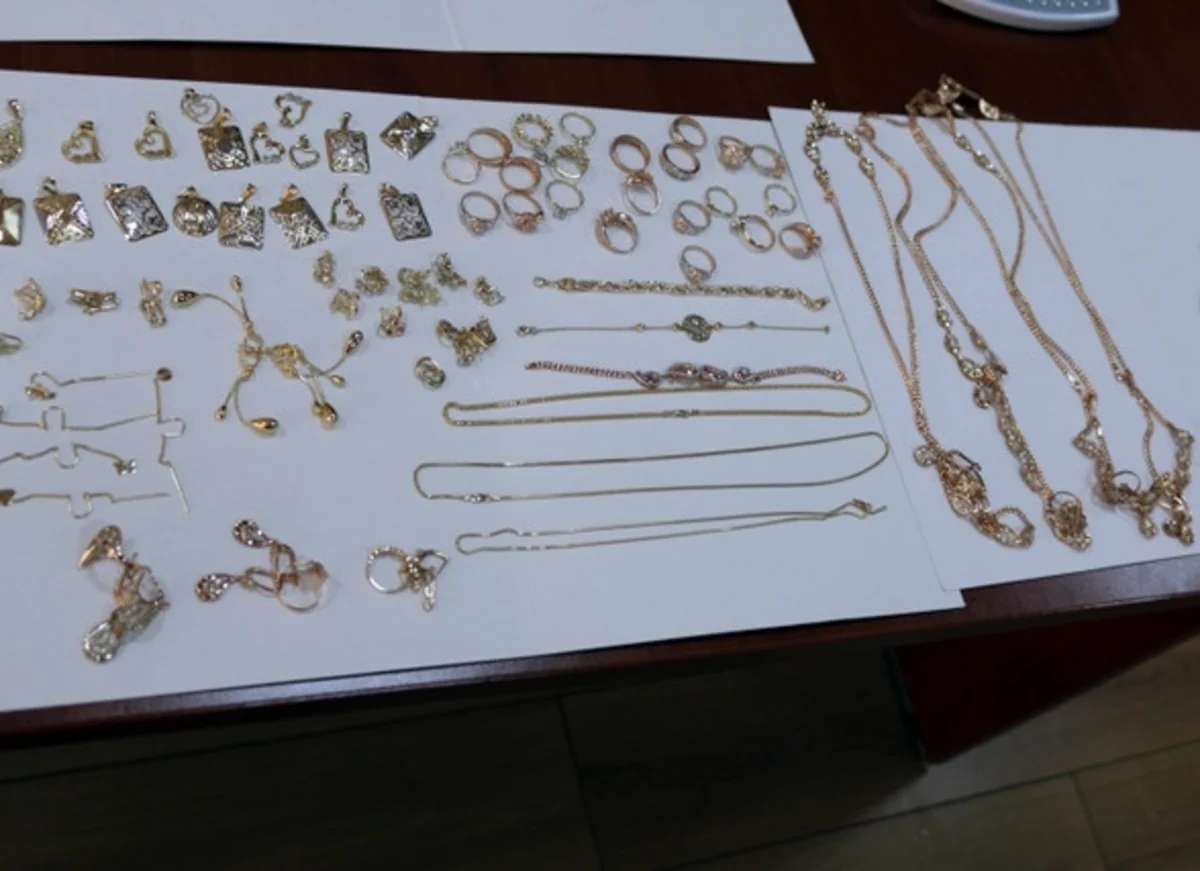 Azərbaycan vətəndaşının daxili orqanından külli miqdarda qızıl-zinət əşyaları çıxıb