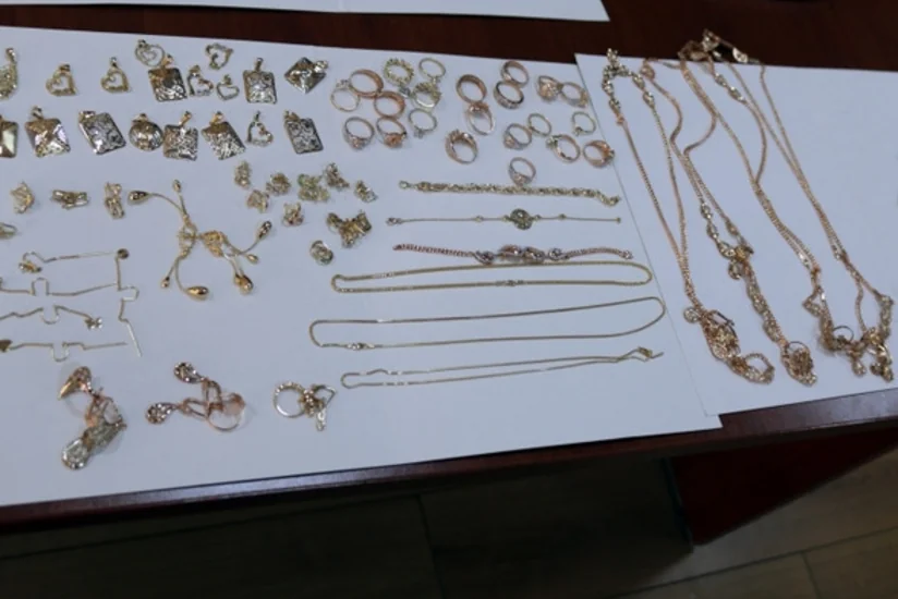 Azərbaycan vətəndaşının daxili orqanından külli miqdarda qızıl-zinət əşyaları çıxıb