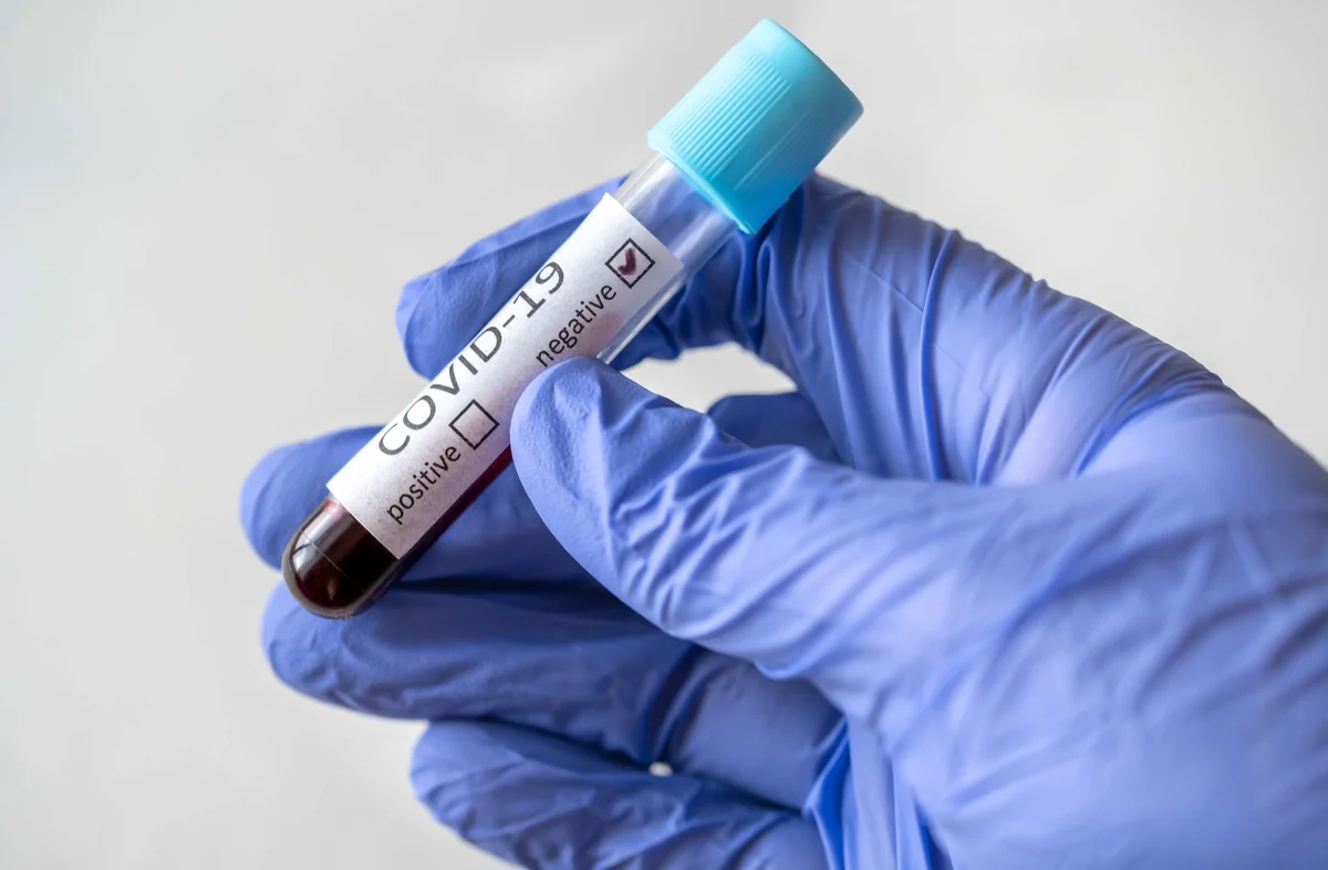 İcbari Tibbi Sığorta Dövlət Agentliyi 5 mln manatlıq koronavirus testi alır
