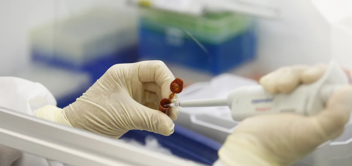 Azerbaijan's Innovation and Supply Center purchases flu vaccines, tests