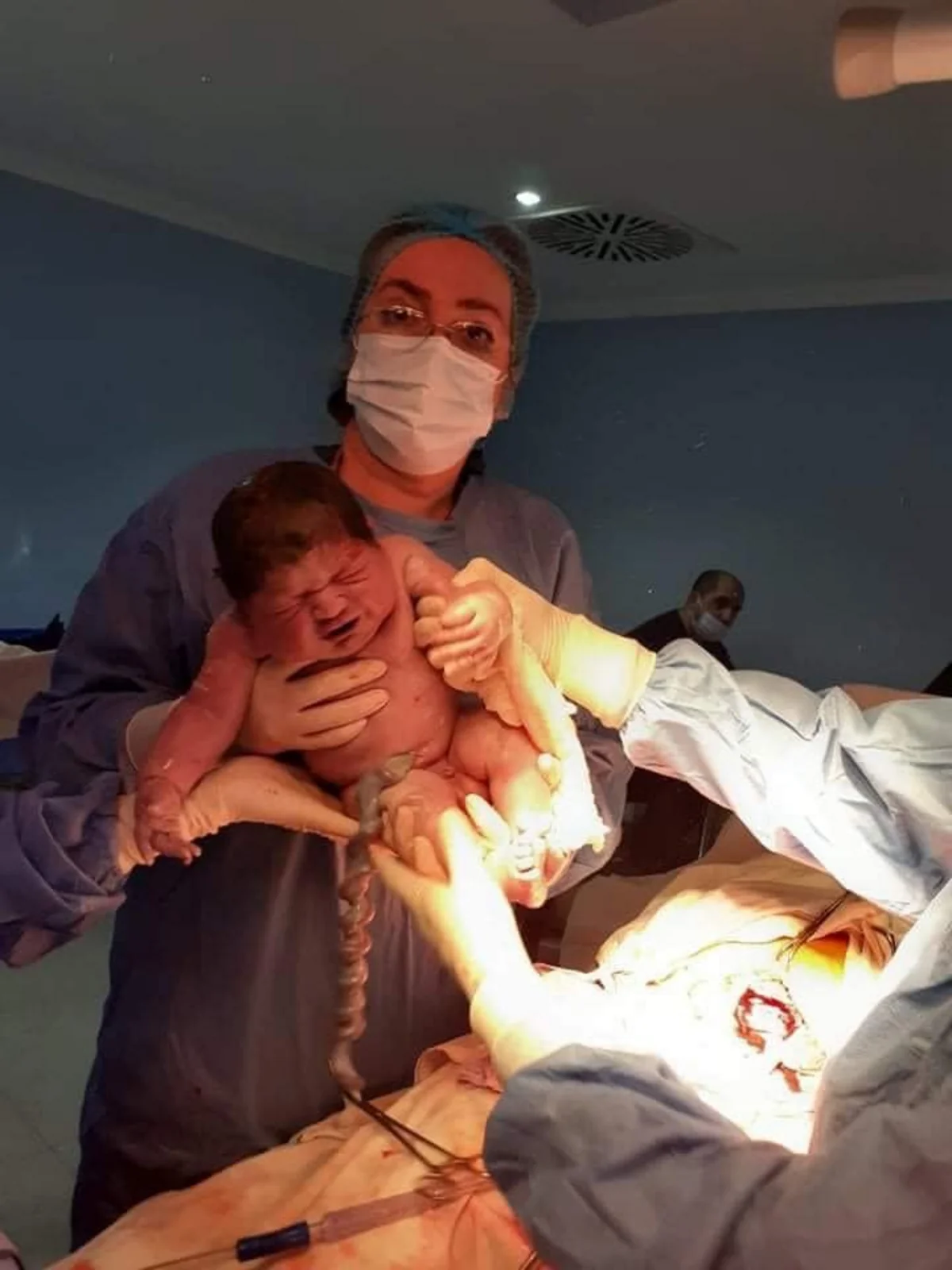 Gürcüstanda 5 kiloqramdan artıq çəkidə körpə doğulub