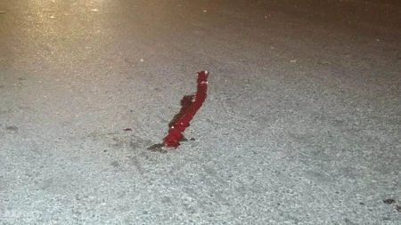 Bakıda tanınmış travmatoloqu maşın vuraraq öldürüb - YENİLƏNİB - FOTO