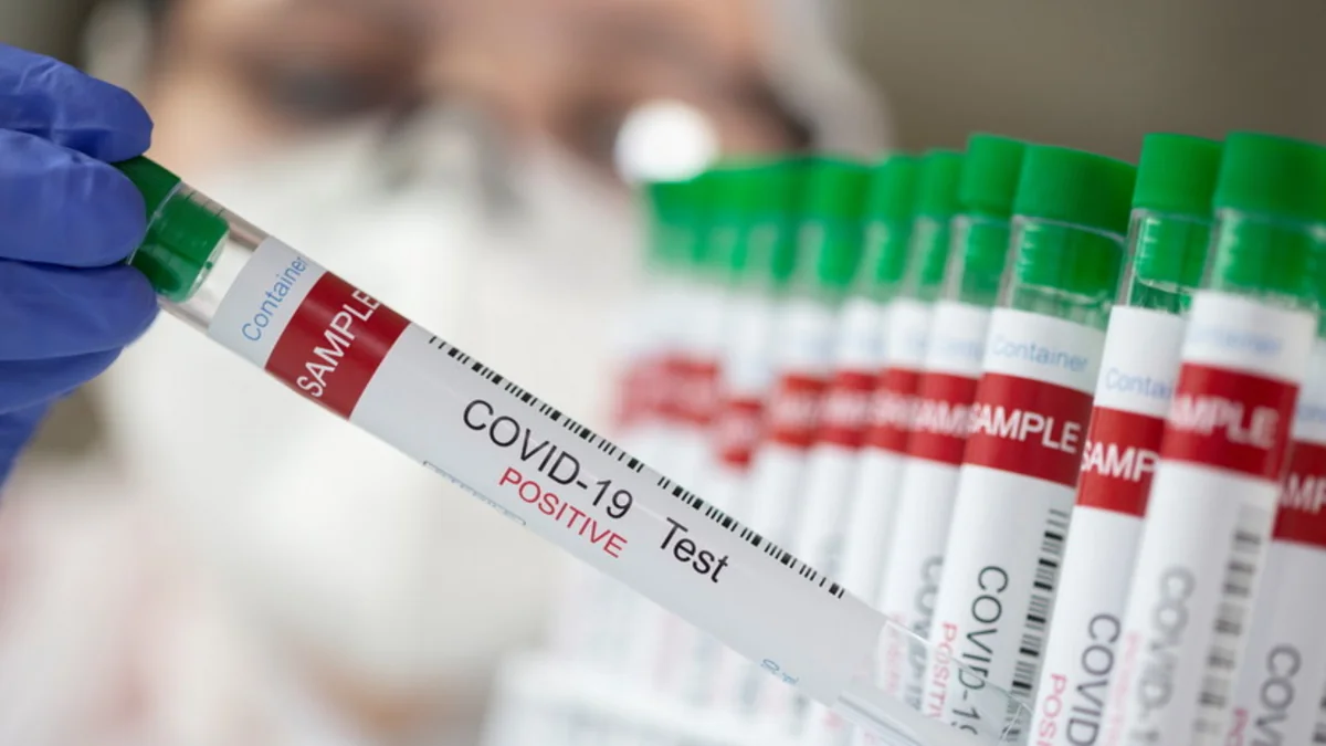 Kolumbiyada son sutkada 25 mindən çox koronavirus yoluxması aşkarlanıb