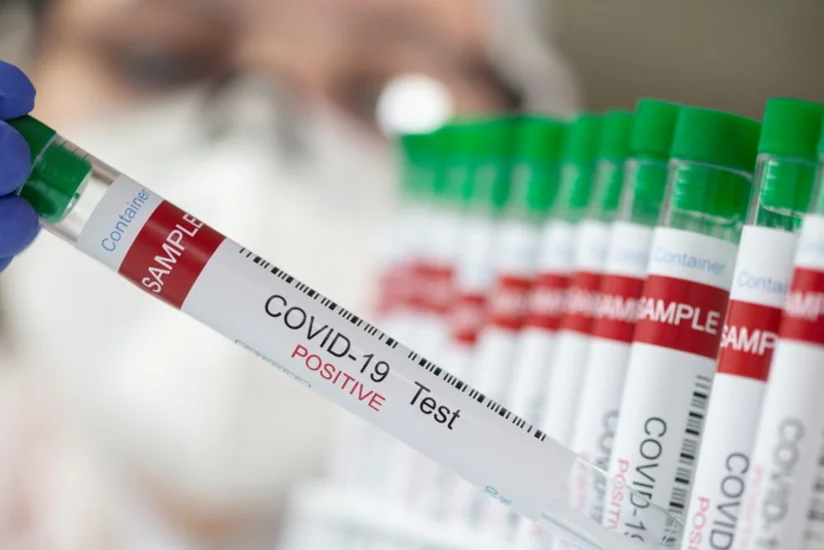 Kolumbiyada son sutkada 25 mindən çox koronavirus yoluxması aşkarlanıb