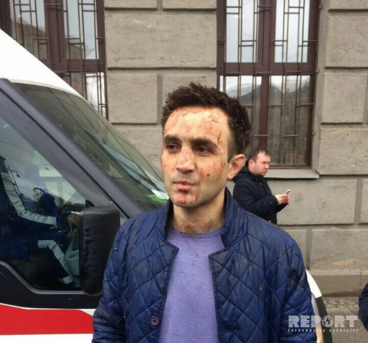 Раненный при теракте в метро Санкт-Петербурга азербайджанец: Смертник стоял прямо рядом со мной