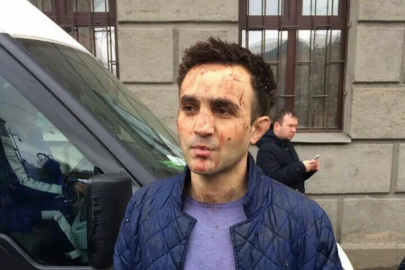 Sankt-Peterburq metrosundakı terrorda yaralanan azərbaycanlı: Terrorçu-kamikadze yanımda dayanmışdı