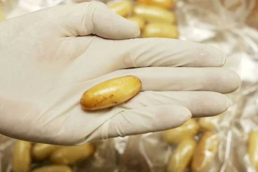 Azərbaycan vətəndaşının daxili orqanında heroin aşkar edilib
