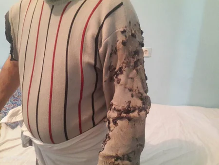 Abşeronda çörək sexində partlayış olub, 3 nəfər ağır yaralanıb - FOTO