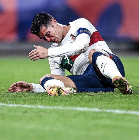 Ronaldu rəqib qapıçı ilə toqquşmadan sonra ciddi xəsarət alıb