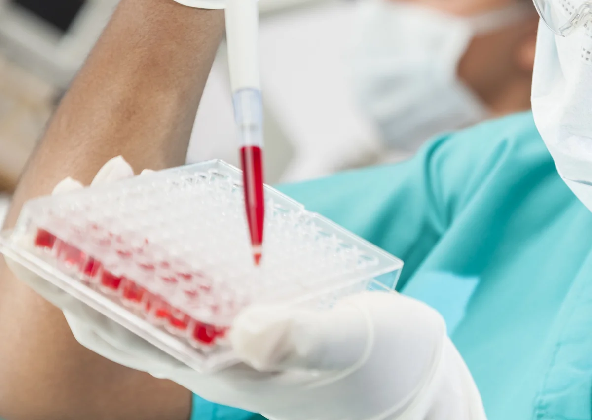 2030-cu ilin sonuna kimi İİV xəstəliyinin qarşısı alına bilər