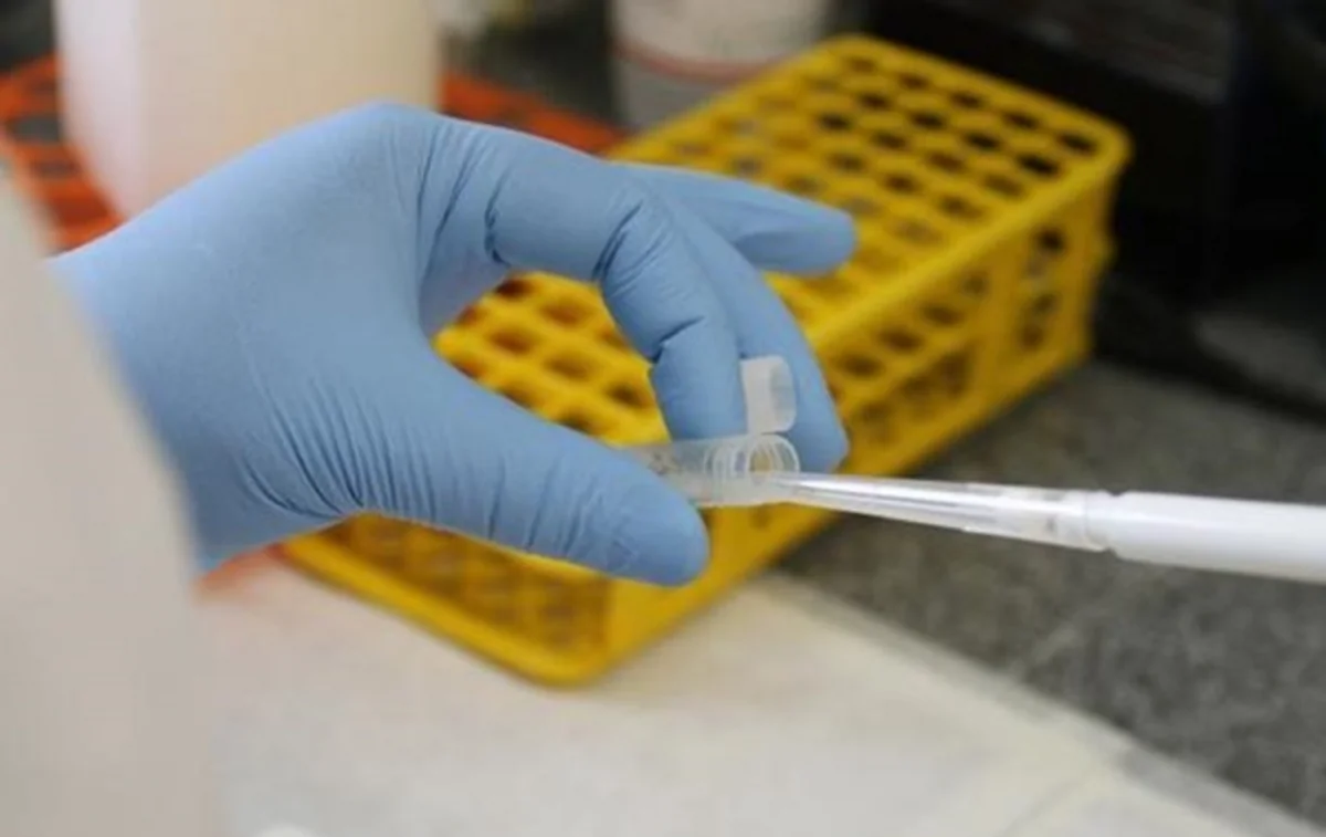 ​Slovakiyada Zika virusuna ilk yoluxma hadisəsi təsdiqlənib