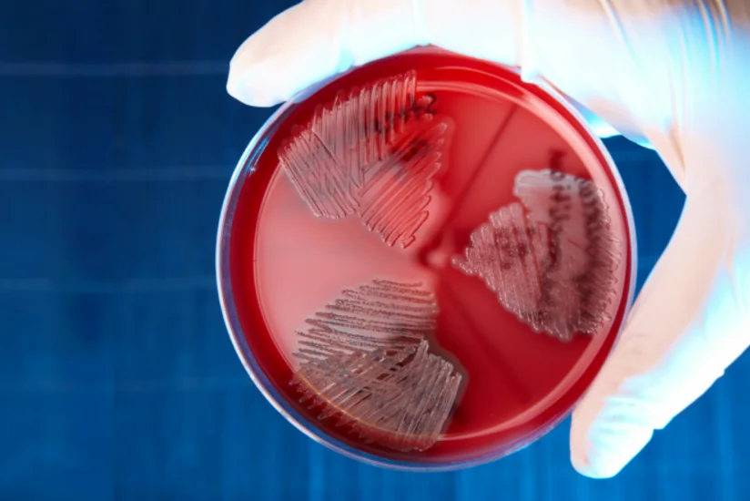 At least 27 people fall ill with streptococcal infection in Hong Kong