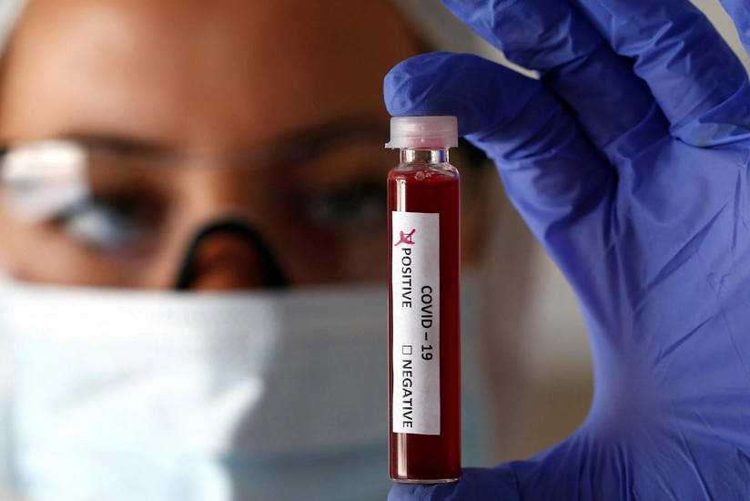 Eris virus detected in 9 people in Türkiye
