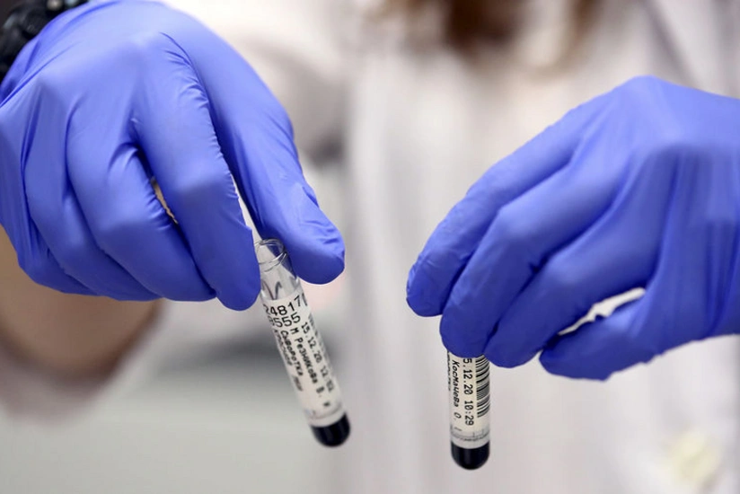 Scientists reveal dangerous symptoms of Indian coronavirus strain