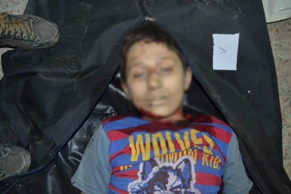 ​Rusiya qırıcıları Hələbin ən böyük xəstəxanasını bombalayıb, 53 dinc sakin həlak olub