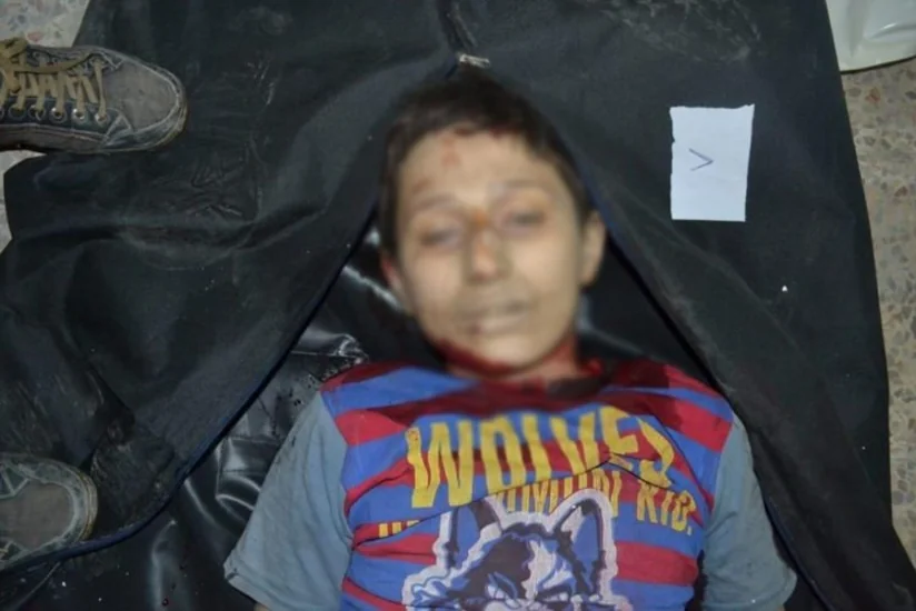 ​Rusiya qırıcıları Hələbin ən böyük xəstəxanasını bombalayıb, 53 dinc sakin həlak olub